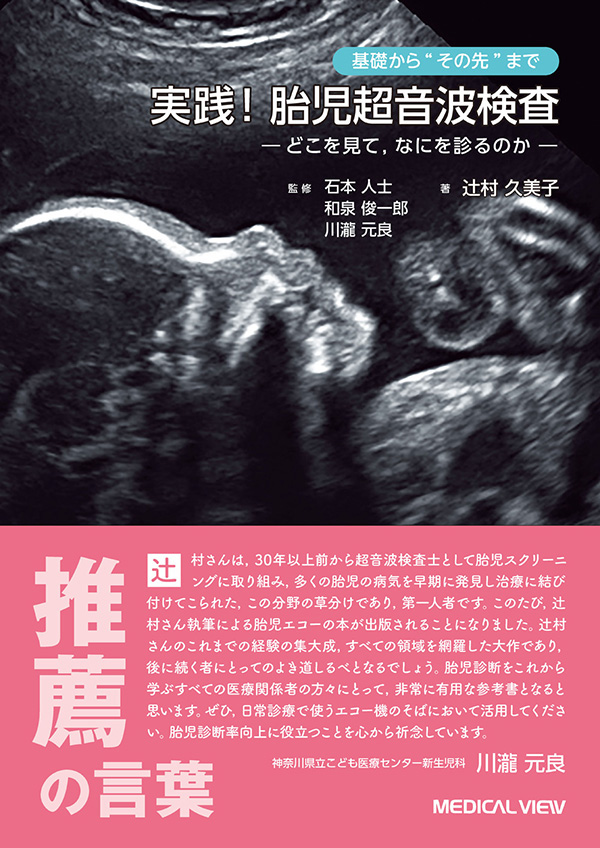 実践! 胎児超音波検査
