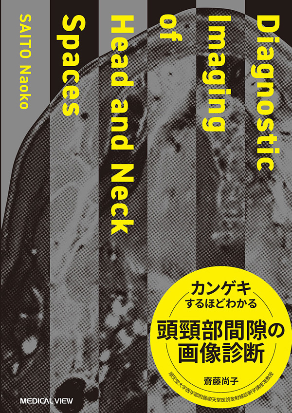カンゲキするほどわかる頭頸部間隙の画像診断