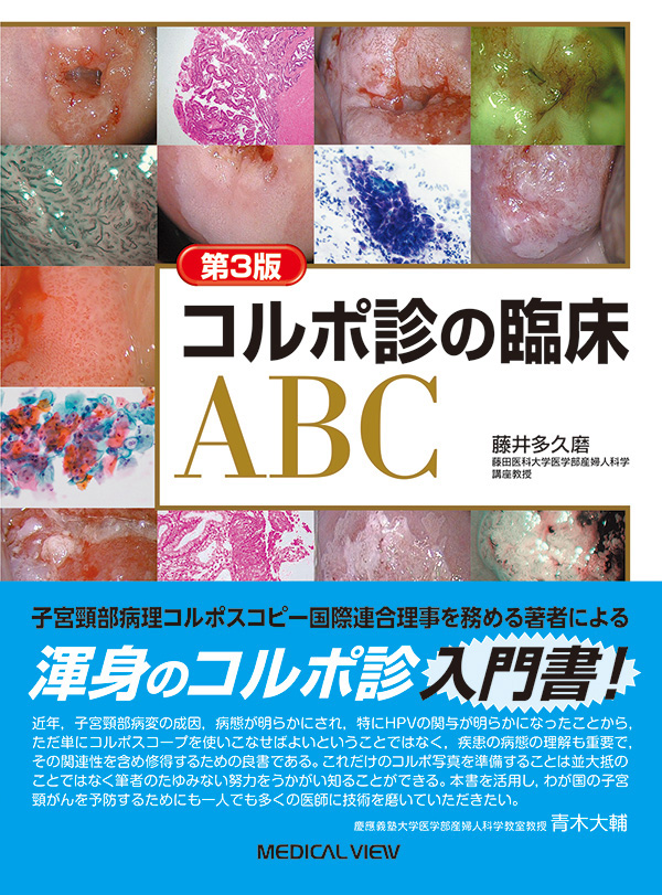 コルポ診の臨床ABC