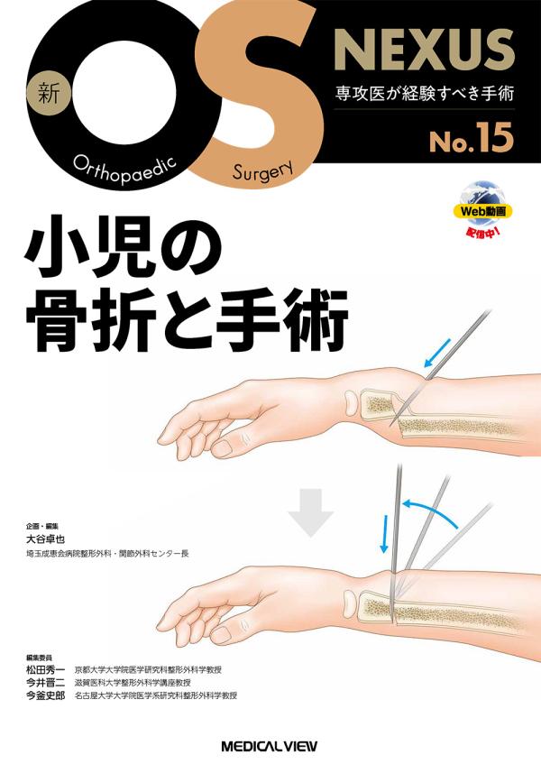 小児の骨折と手術［Web動画付］