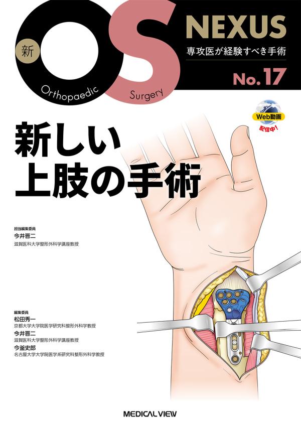 新しい上肢の手術［Web動画付］