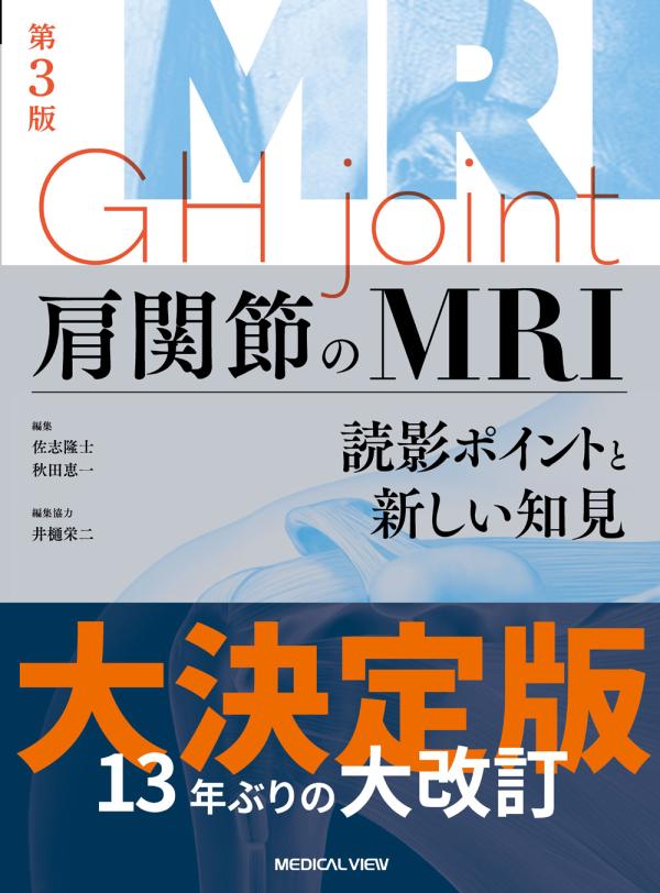 肩関節のMRI