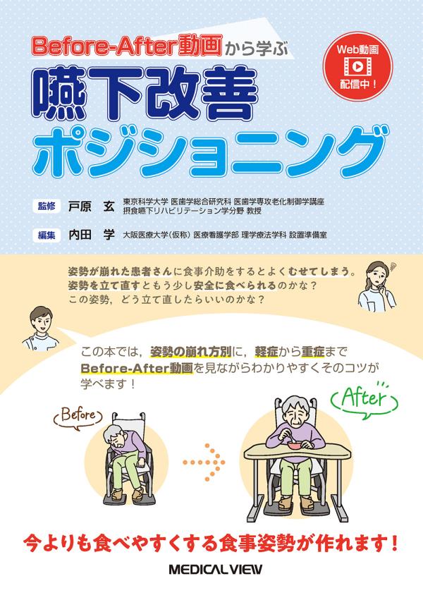 嚥下改善ポジショニング［Web動画付］