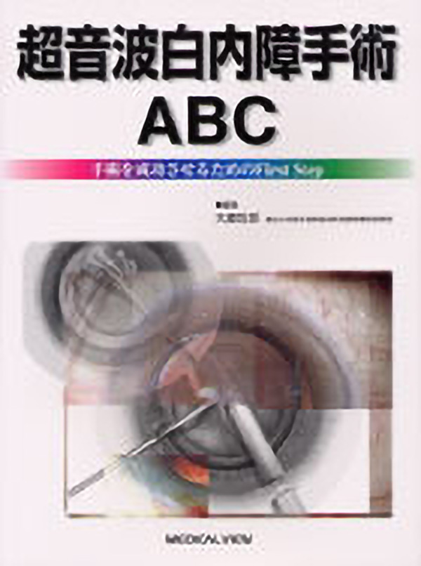 超音波白内障手術ABC