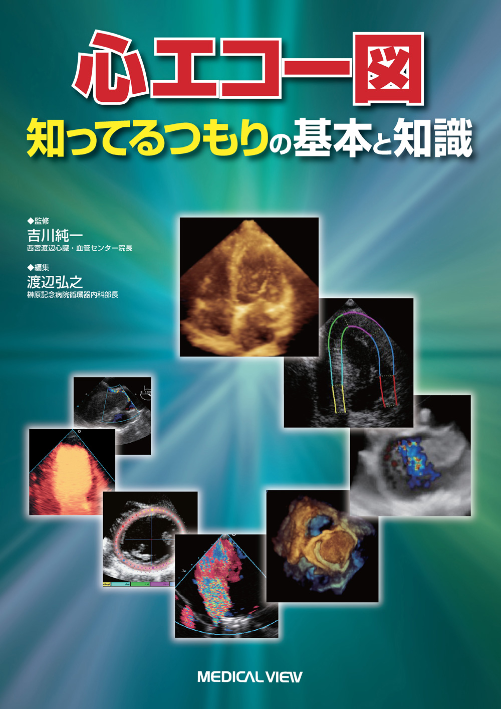 メジカルビュー社 画像医学 放射線医学 心エコー図 知ってるつもりの基本と知識