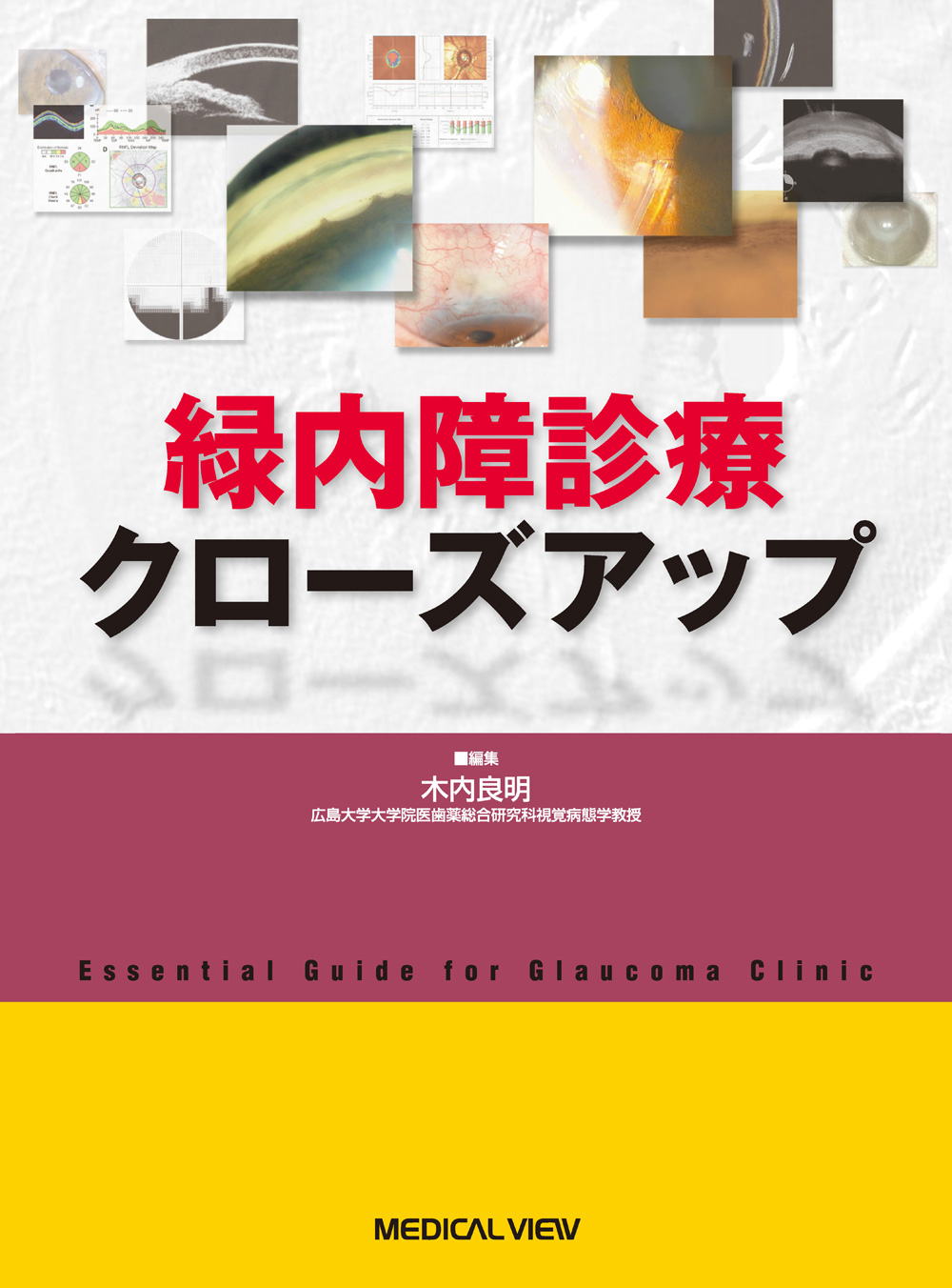 メジカルビュー社｜眼科｜緑内障診療クローズアップ