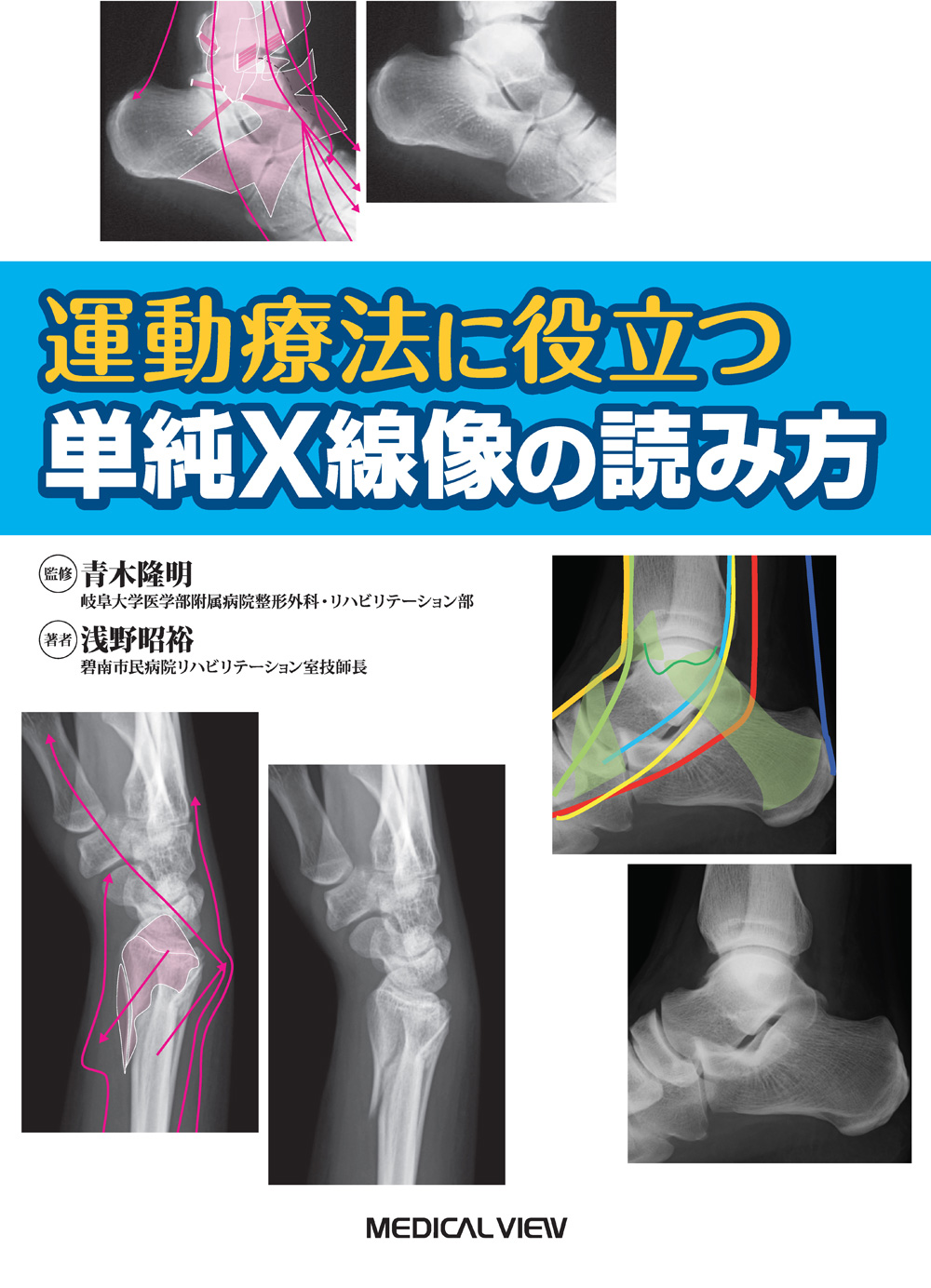 メジカルビュー社 作業療法士 運動療法に役立つ 単純x線像の読み方 メジカルビュー社 作業療法士 運動療法に役立つ 単純x線像の読み方