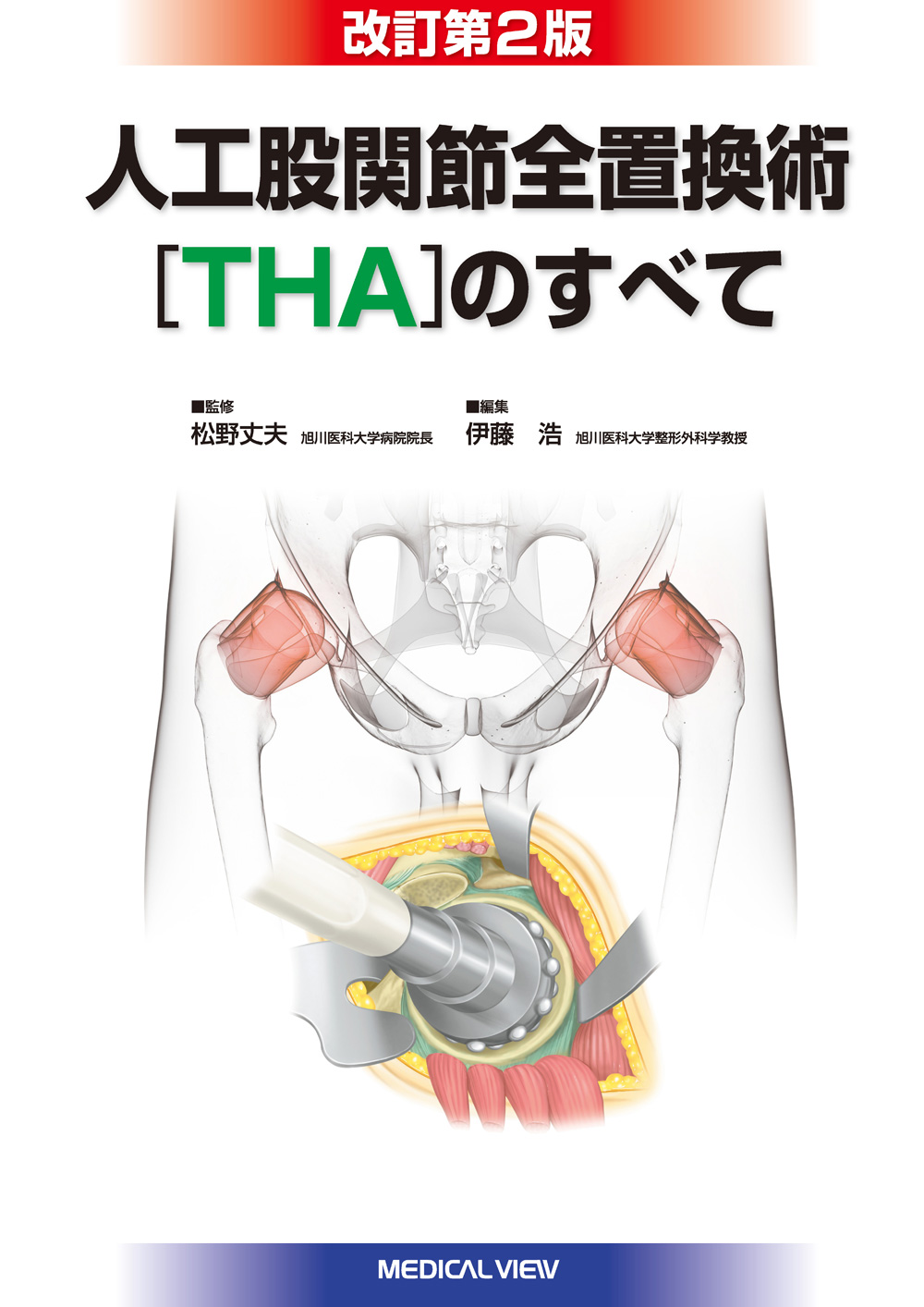 メジカルビュー社｜整形外科｜人工股関節全置換術[THA]のすべて