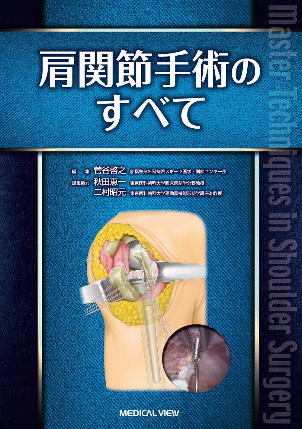 メジカルビュー社｜整形外科｜肩関節手術のすべて