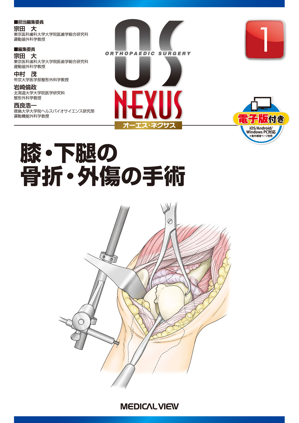 メジカルビュー社｜整形外科｜OS NEXUS（電子版付き） 1 膝・下腿の 