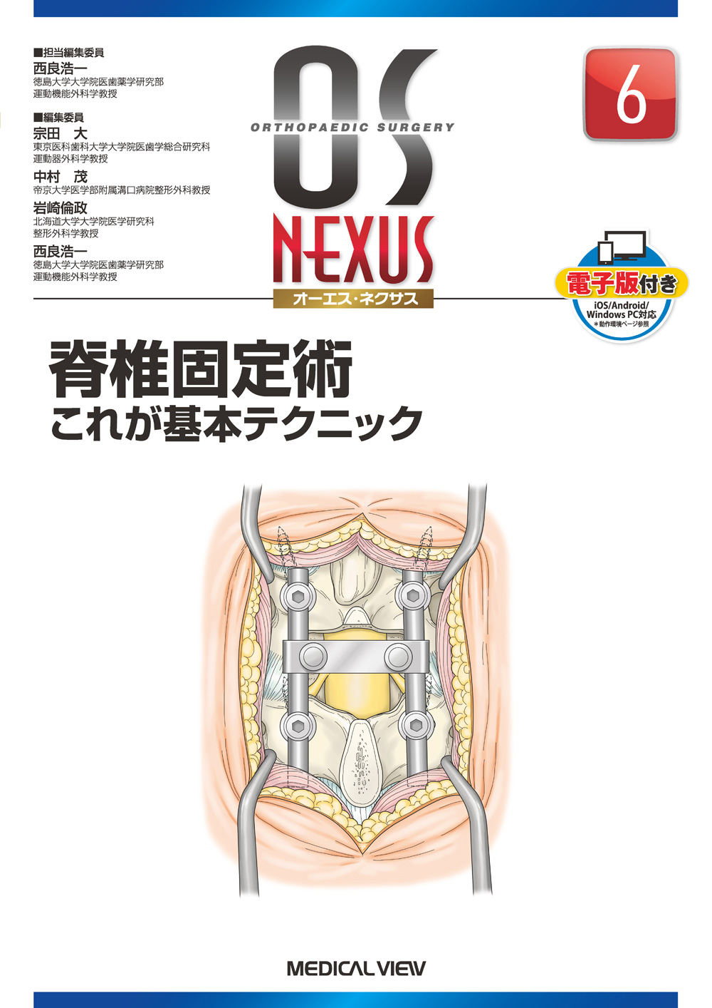 匠が伝える低侵襲脊椎外科の奥義