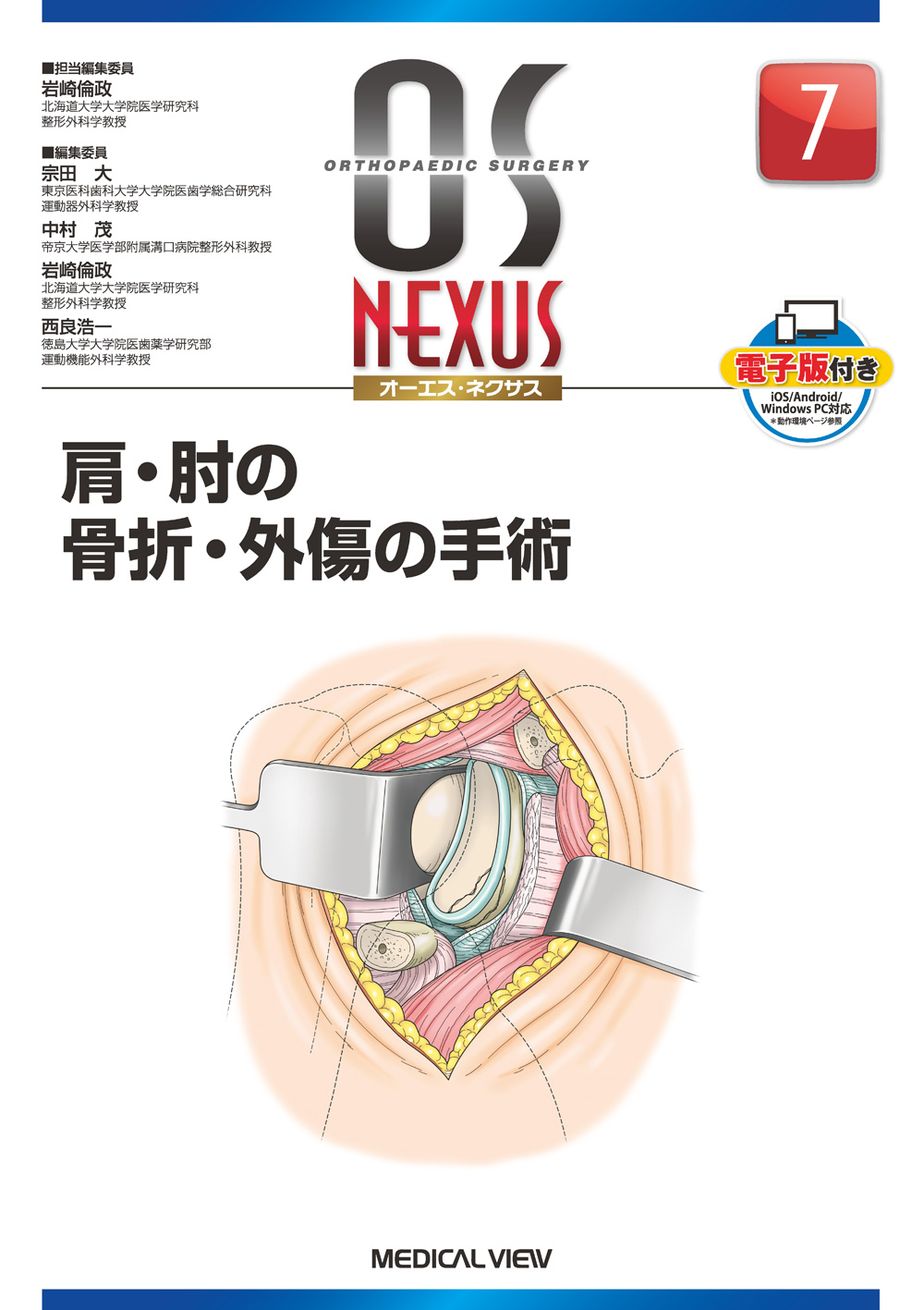 高齢者上肢骨折に対する手術 (OS NEXUS(電子版付き) 13) [単行本] 岩崎 倫政
