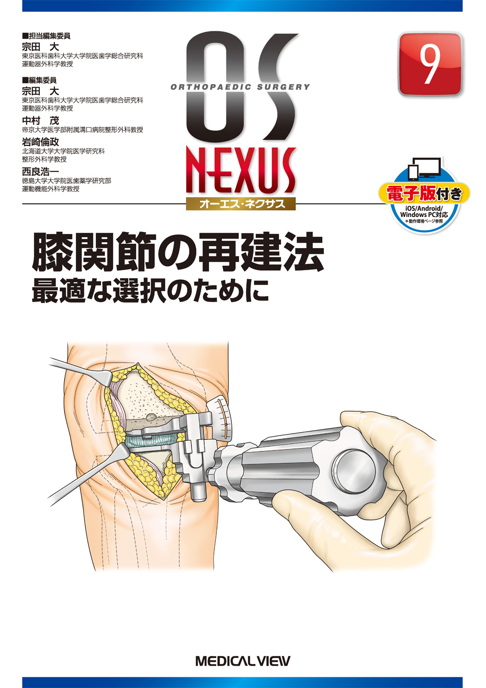 メジカルビュー社｜整形外科｜OS NEXUS（電子版付き） 9 膝関節の再建法