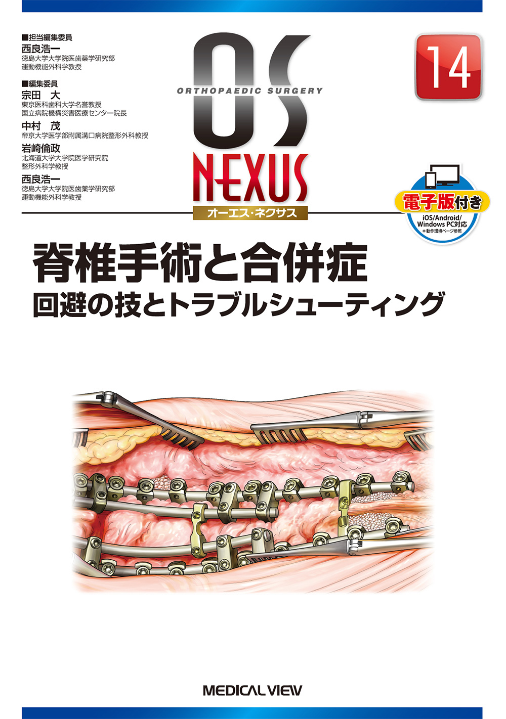 メジカルビュー社｜整形外科｜OS NEXUS（電子版付き） 14 脊椎手術と合併症