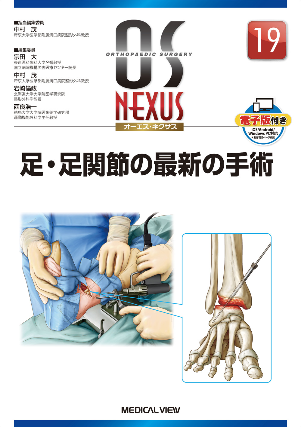 メジカルビュー社｜整形外科｜OS NEXUS（電子版付き） 19 足・足関節の 