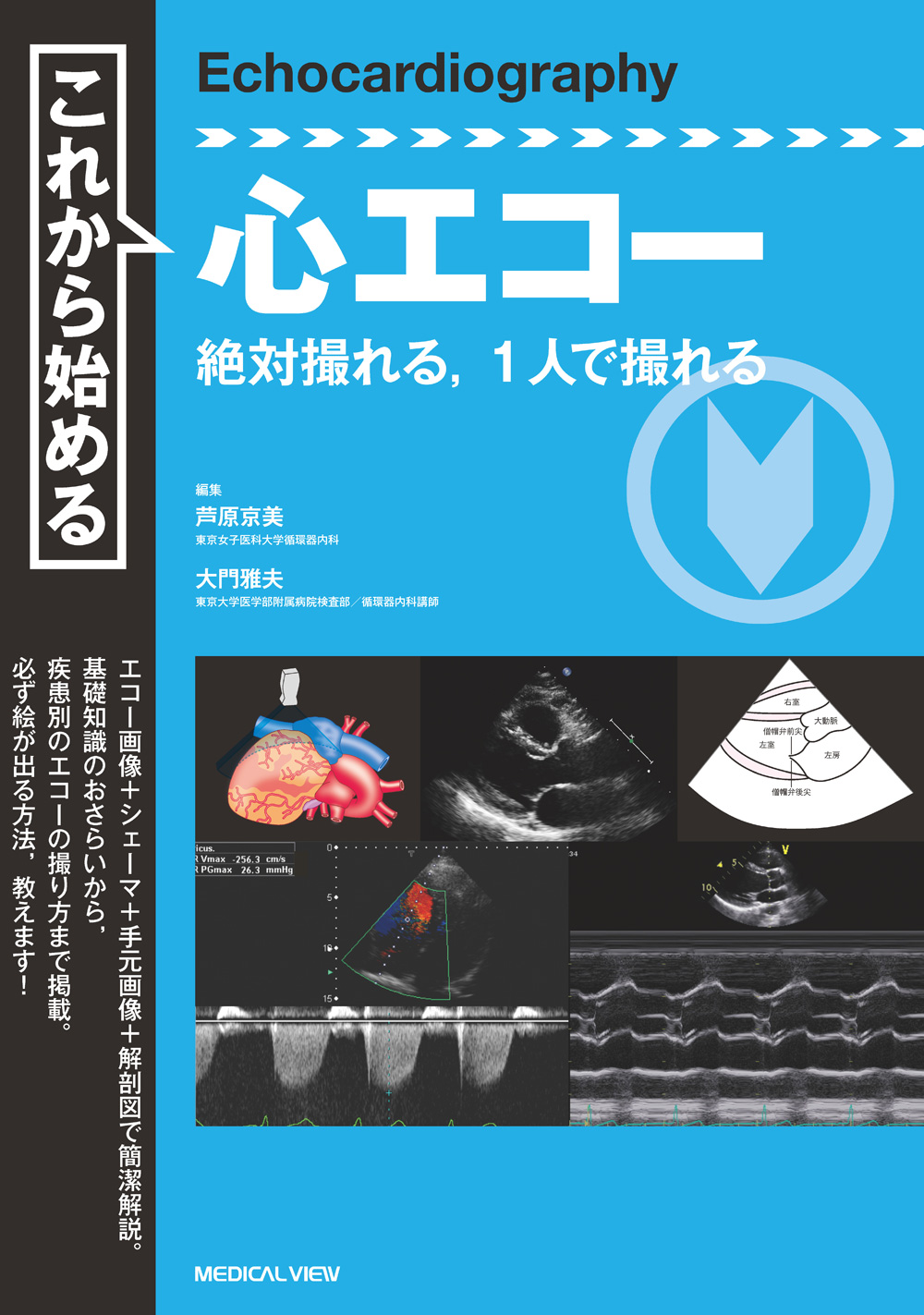 メジカルビュー社 画像医学 放射線医学 これから始める心エコー