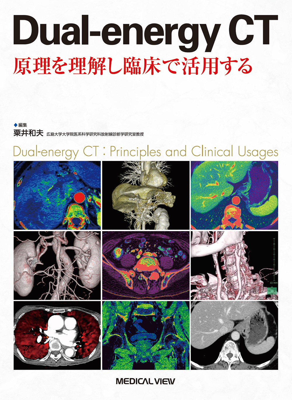 メジカルビュー社｜診療放射線技師｜Dual-energy CT