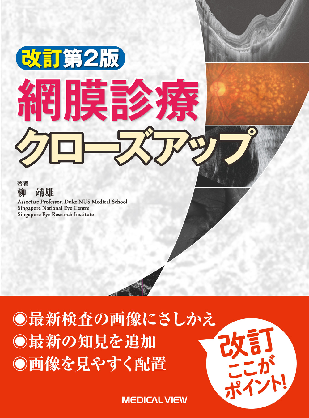 新 眼科診察クローズアップ