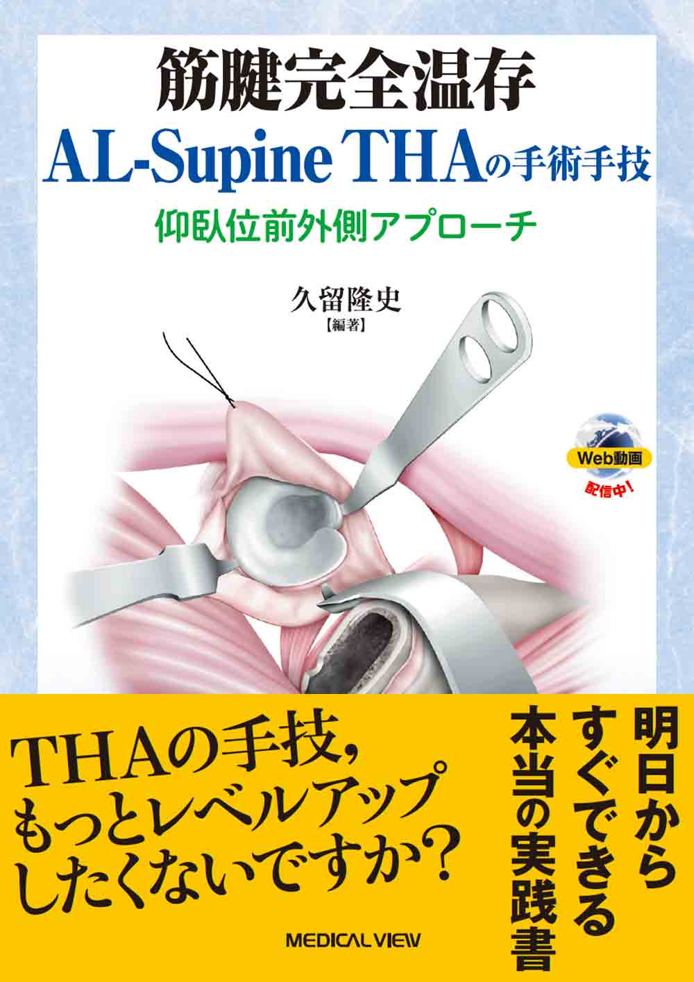 メジカルビュー社｜整形外科｜筋腱完全温存AL-Supine THAの手術手技