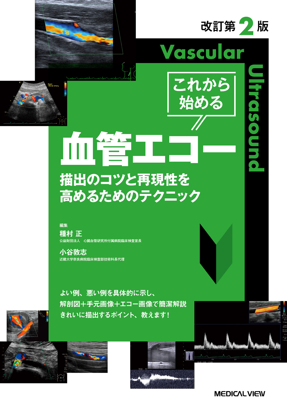 メジカルビュー社｜臨床検査技師｜これから始める血管エコー