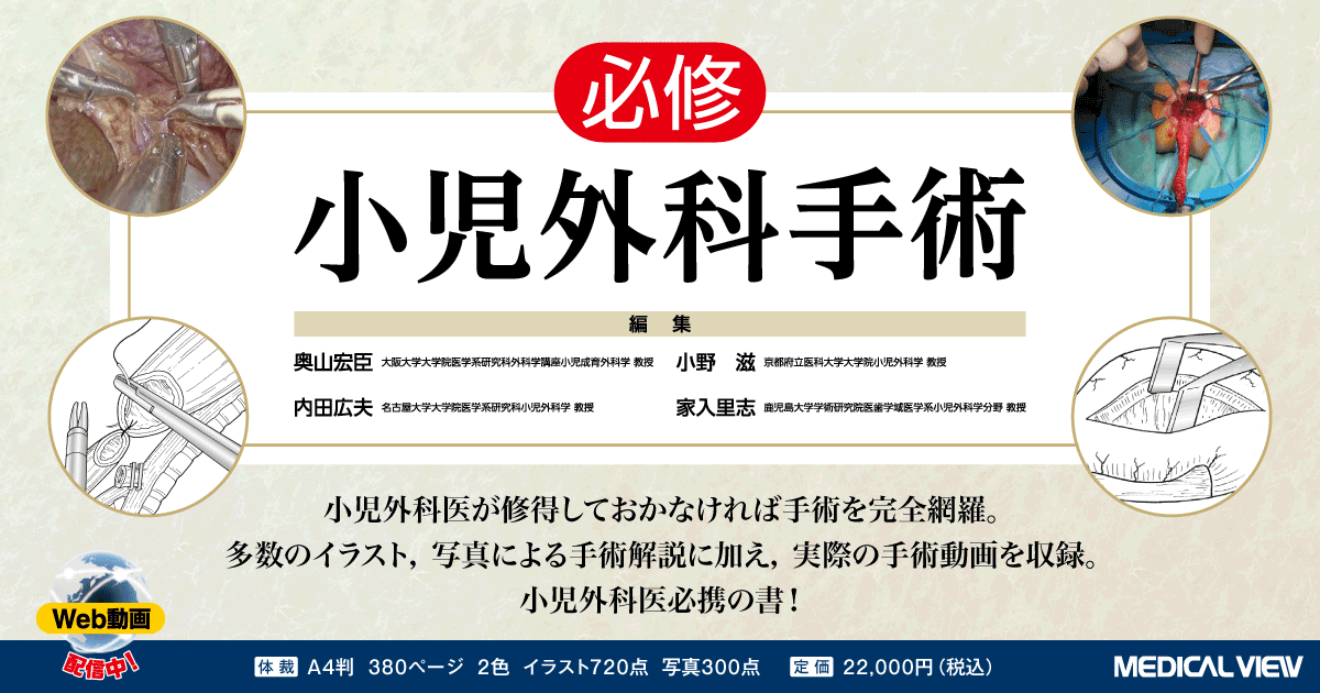 臍の外科 小児の臍疾患治療と臍を利用した手術 メジカルビュー社｜小児外科｜必修 小児外科手術［Web動画付］