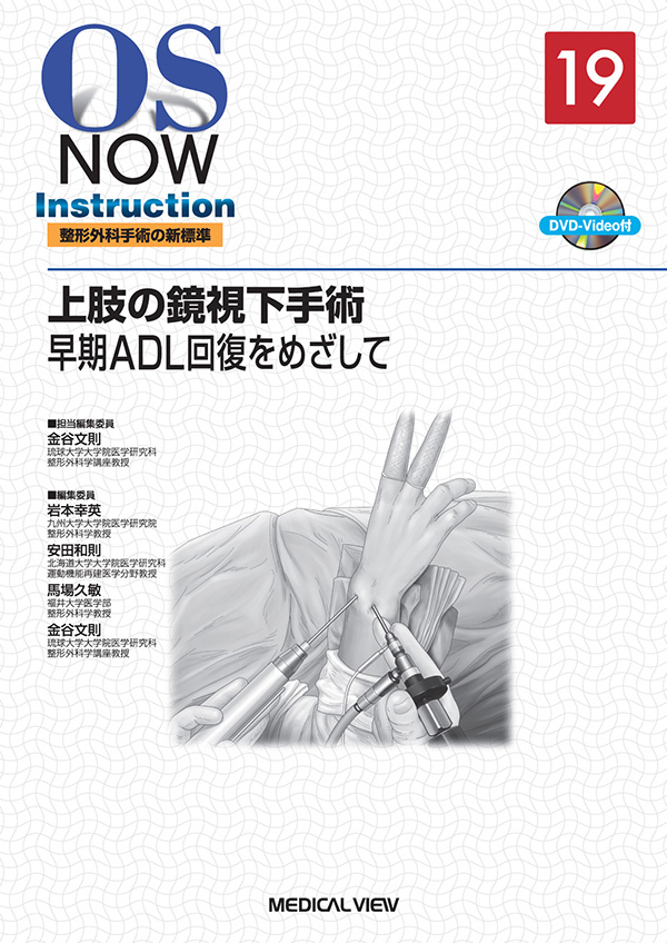 楽天ブックス: 整形外科手術のための解剖学ー上肢 - 長野昭