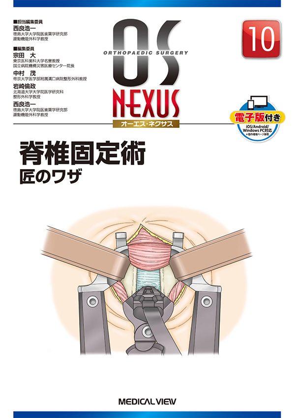 メジカルビュー社｜整形外科｜OS NEXUS（電子版付き） 10 脊椎固定術 