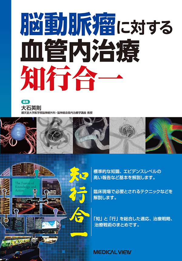 メジカルビュー社｜脳神経外科｜脳動脈瘤に対する血管内治療 知行 ...