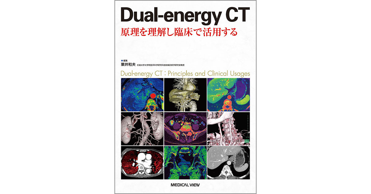 メジカルビュー社｜画像医学・放射線医学｜Dual-energy CT