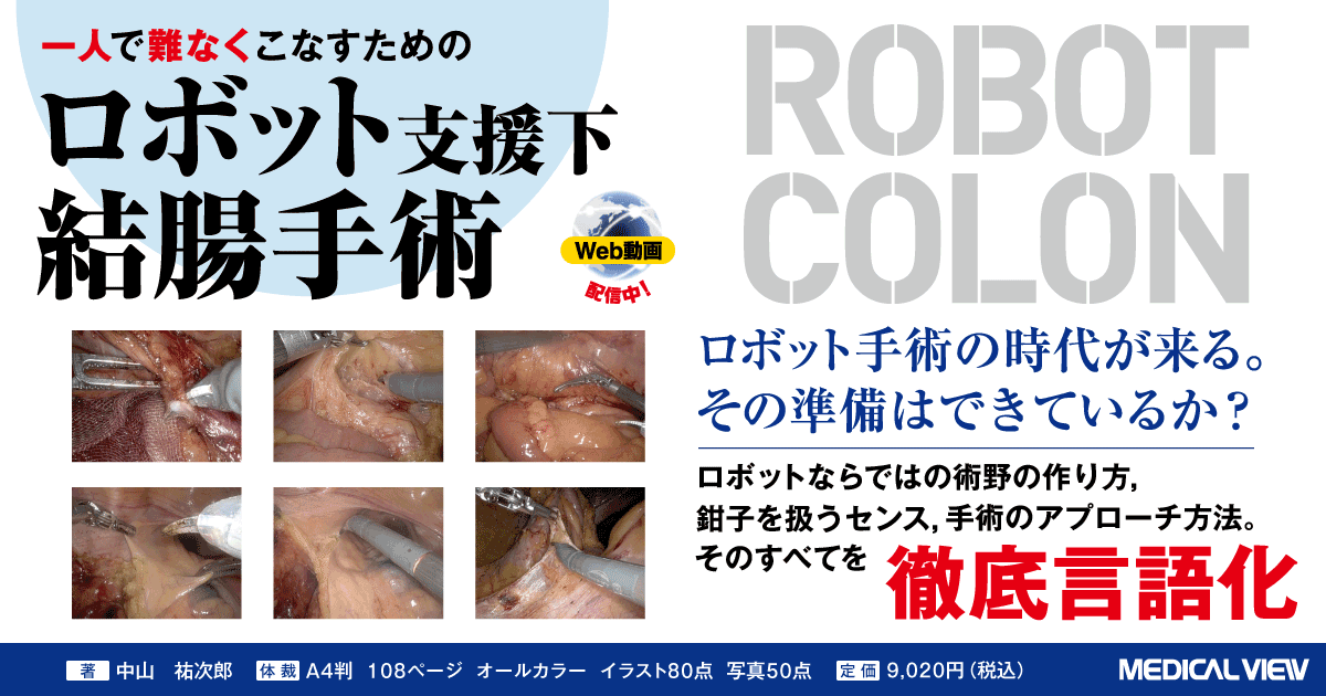 メジカルビュー社｜消化器外科｜ロボット支援下結腸手術［Web