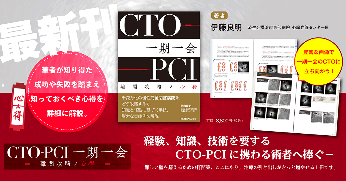 CTO-PCI一期一会 : 難関攻略ノ心得 CTO-PCI 一期一会 難関攻略ノ心得 | 伊藤 良明 |本 | 通販 | Amazon