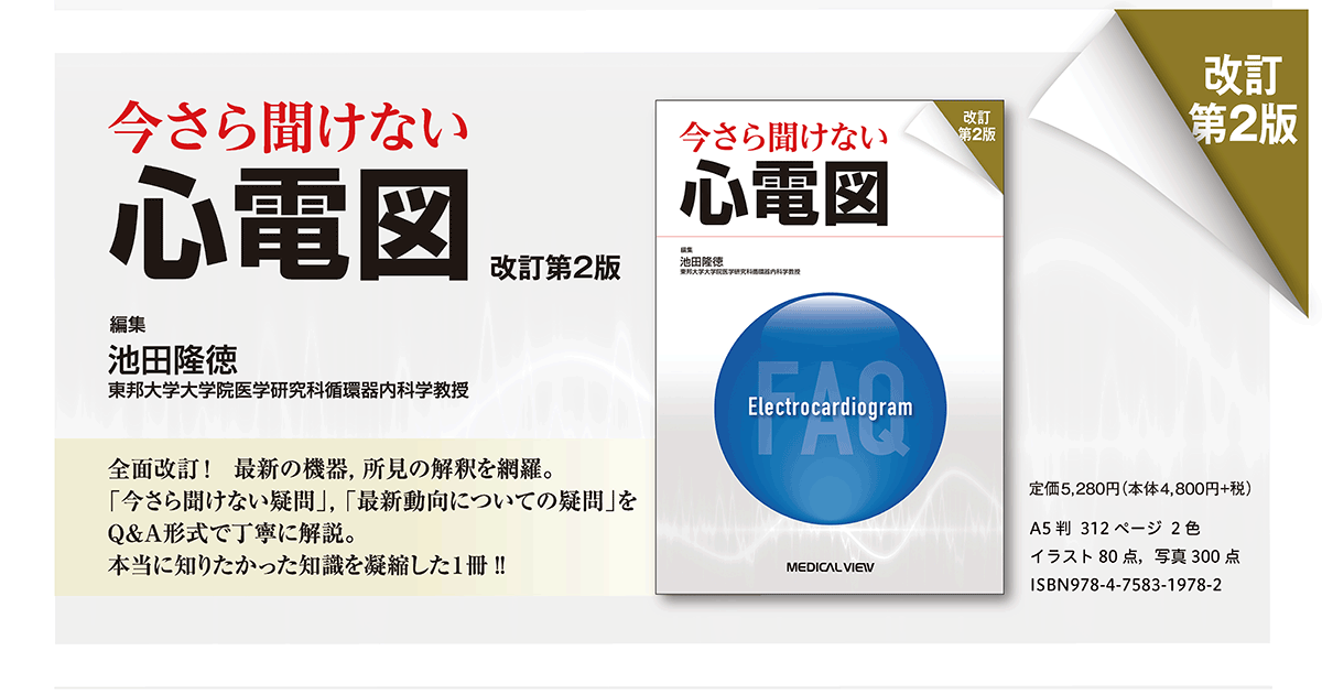 心電図最後の教科書 不整脈編 | 谷口 総志 |本 | 通販 | Amazon