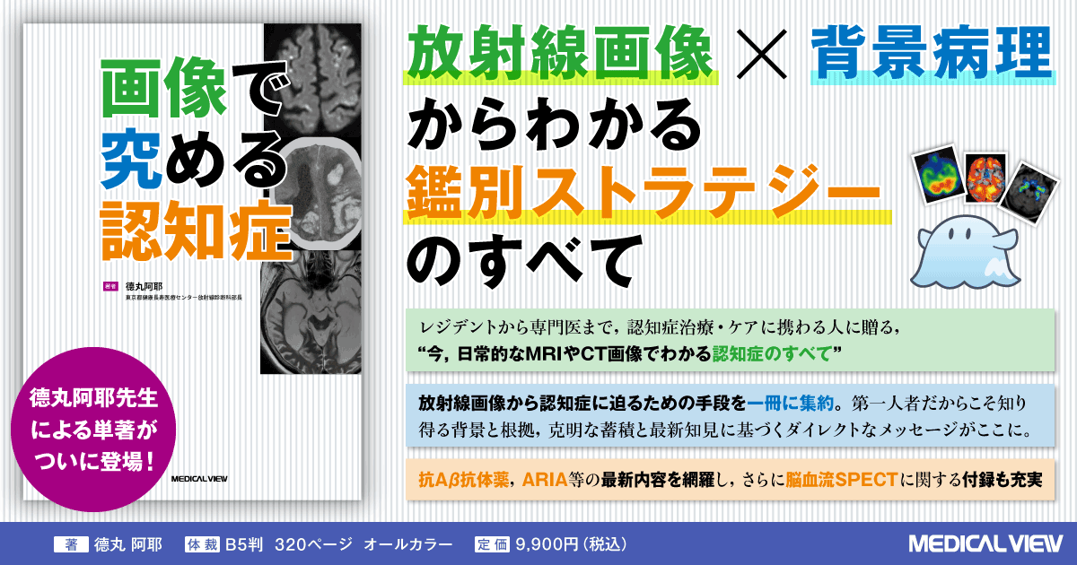 その他サービス | 福利厚生 メジカルビュー社｜画像医学・放射線医学｜画像で究める認知症 健康・医学