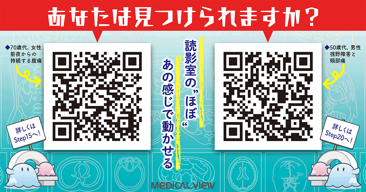 メジカルビュー社｜画像医学・放射線医学｜1カ月・30Stepで学ぶ
