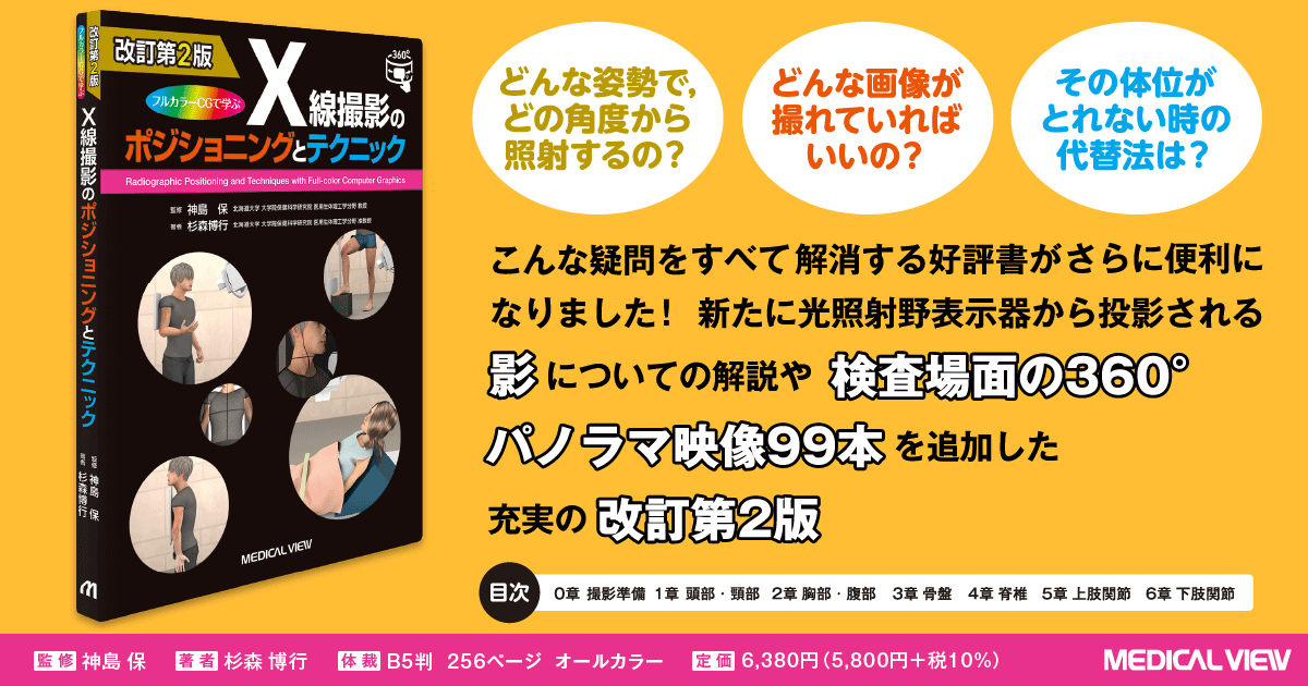 メジカルビュー社｜診療放射線技師｜X線撮影のポジショニングとテクニック