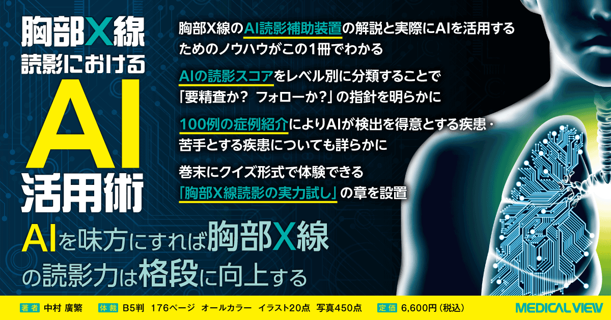 メジカルビュー社|画像医学・放射線医学|胸部X線読影における メジカルビュー社|画像医学・放射線医学|胸部X線読影における