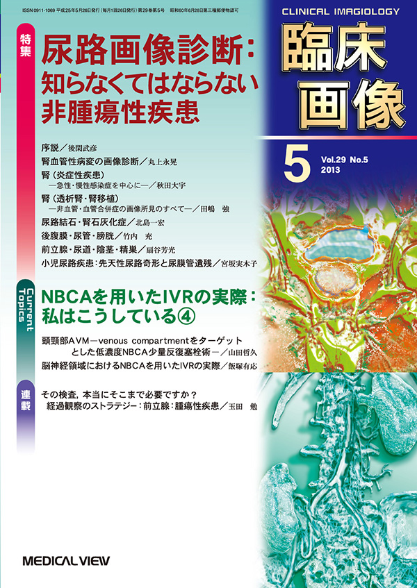 臨床画像 2013年5月号
