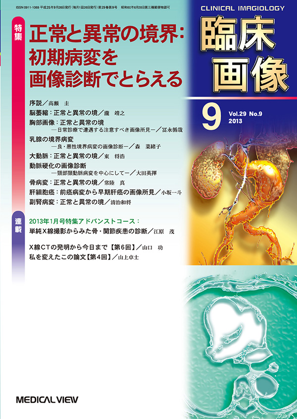 臨床画像 2013年9月号