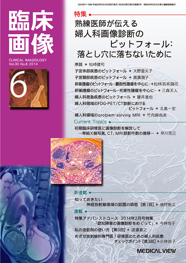 臨床画像 2014年6月号