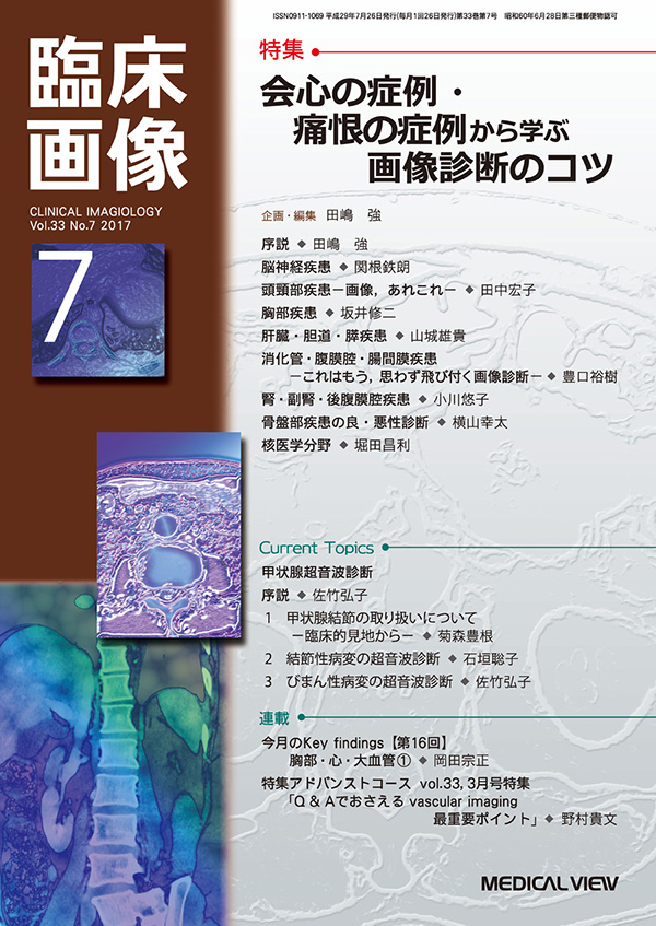 臨床画像 2017年7月号