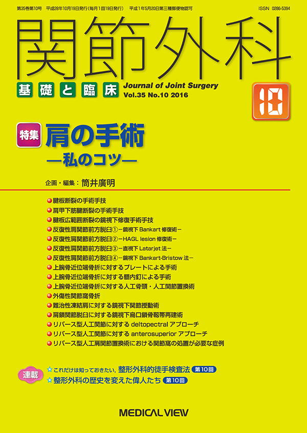 関節外科 2016年10月号