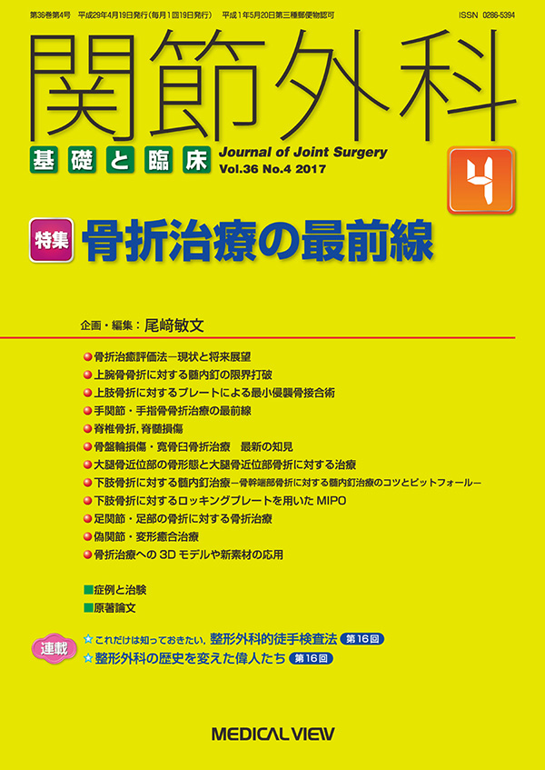 関節外科 2017年4月号