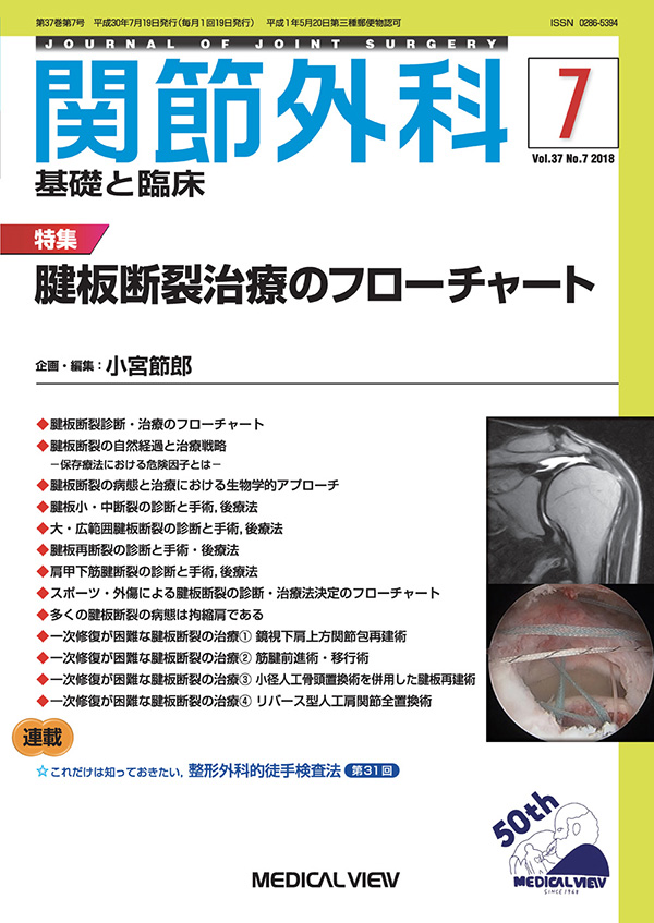 関節外科 2018年7月号