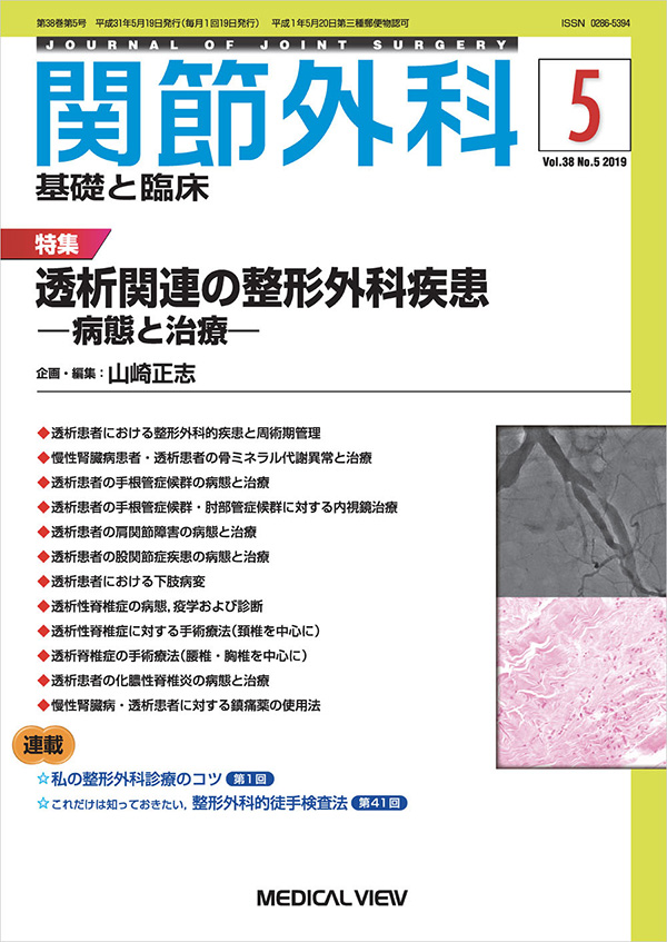 関節外科 2019年5月号