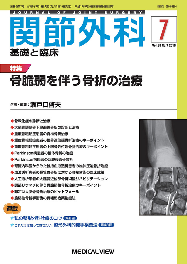 関節外科 2019年7月号