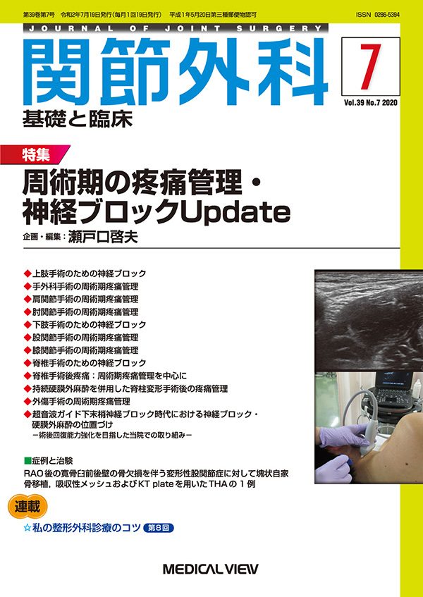 関節外科 2020年7月号