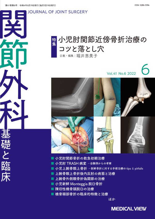 関節外科 2022年6月号