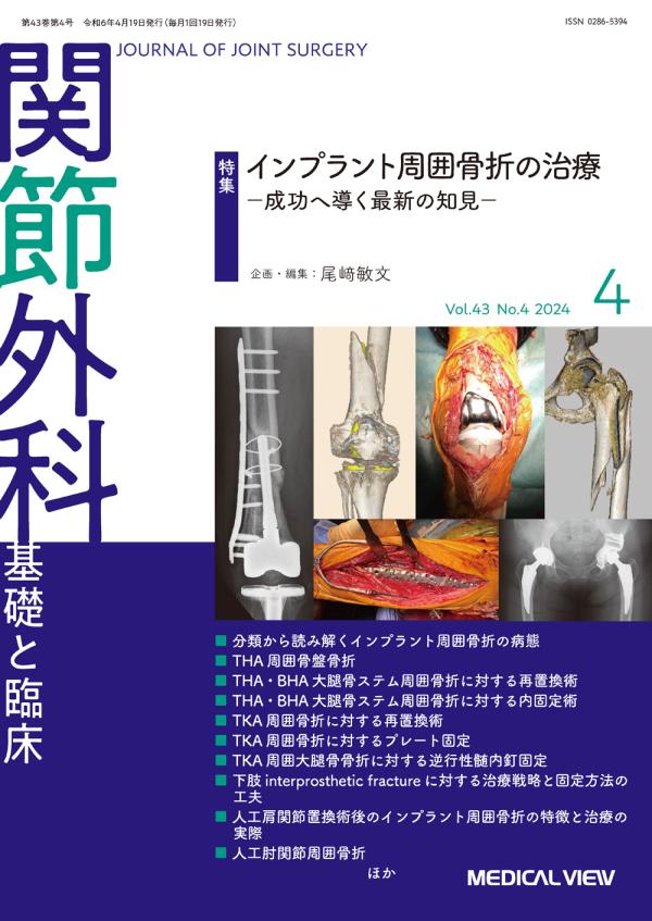 関節外科 2024年4月号