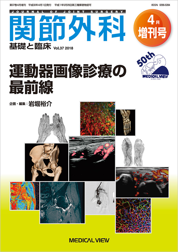 関節外科 2018年4月増刊号