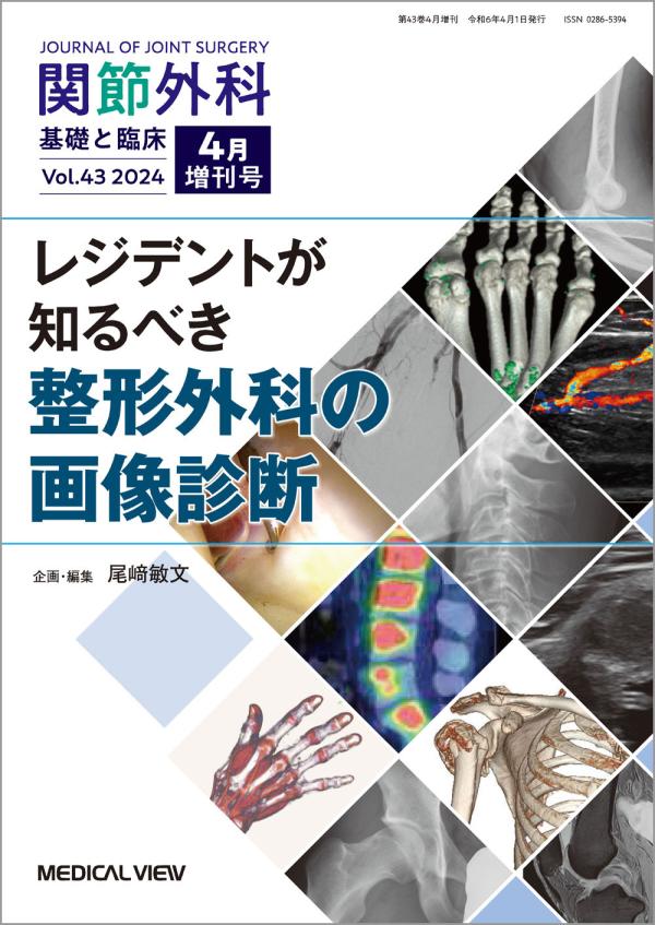 関節外科 2024年4月増刊号